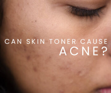 How To Use Toner For Acne