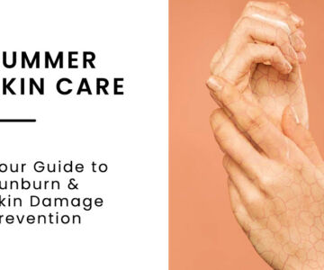 summer skin care: your guide to sunburn and skn care prevention