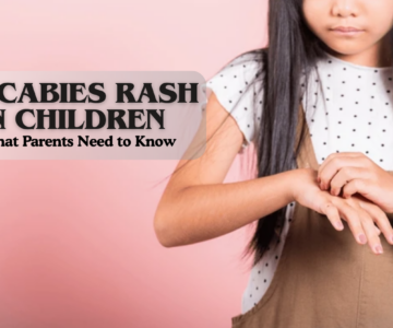 Scabies Rash in Children What Parents Need to Know