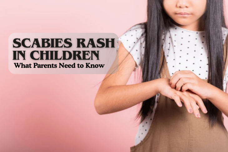 Scabies Rash in Children What Parents Need to Know