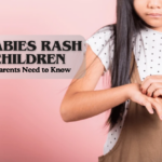 Scabies Rash in Children What Parents Need to Know