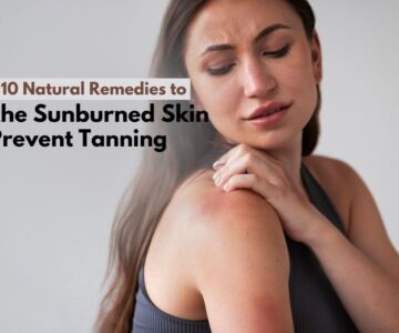 Top 10 Natural Remedies to Soothe Sunburned Skin and Prevent Tanning