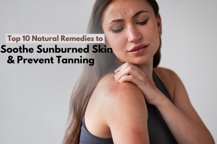 Top 10 Natural Remedies to Soothe Sunburned Skin and Prevent Tanning