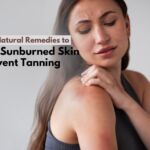 Top 10 Natural Remedies to Soothe Sunburned Skin and Prevent Tanning